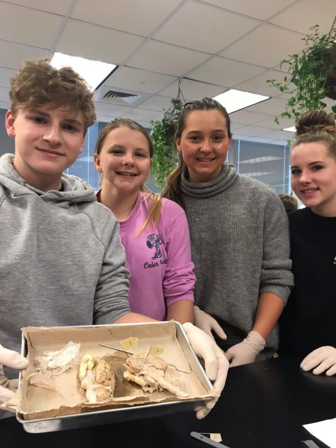 Ethan Apple, Jillian Bowman, Molly Bobik, and Kylie Blaszkowski showcase the sheep brain they dissected in anatomy class.